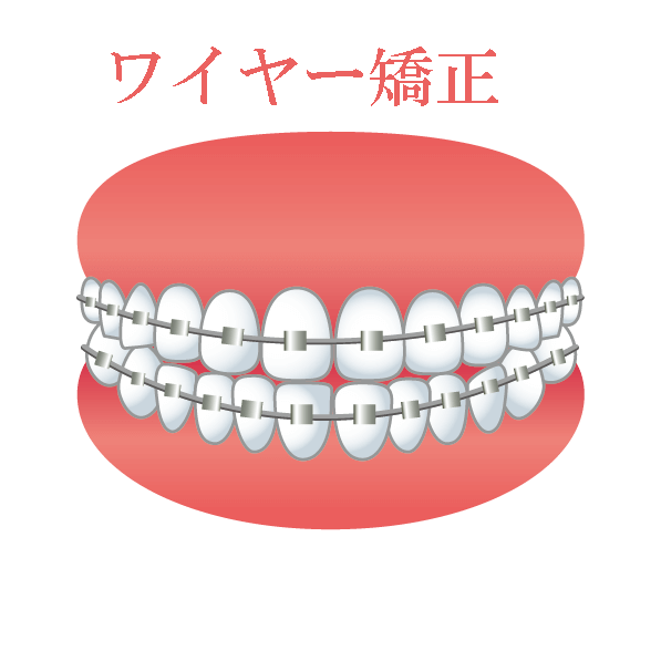 マルチブラケット
